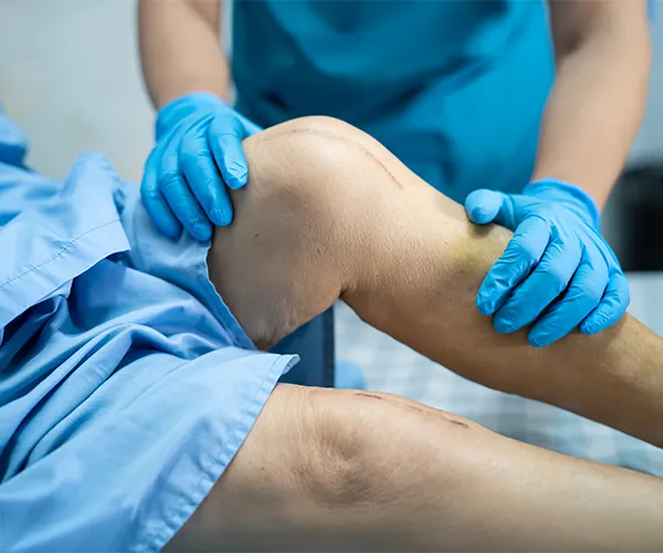 تقنية متقدمة لاستبدال الركبة في الهند